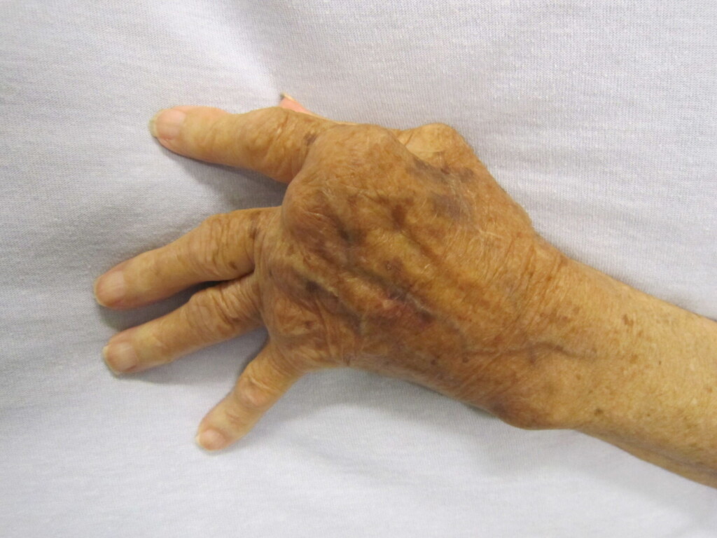 elderly physiotherapy