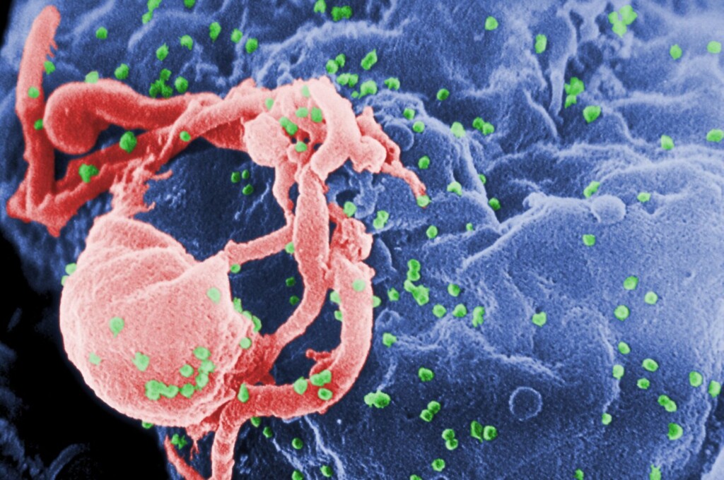 living HIV
