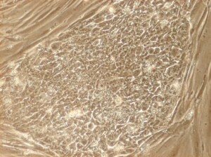 stem-cell-ethics